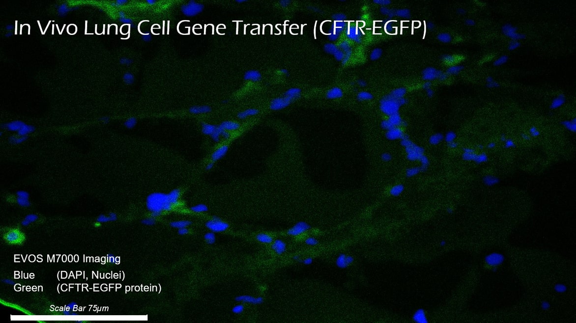 Close up of lung transfer